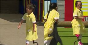 Menina vai à escola com sua prótese e reação de amigas emociona