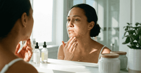 Acne depois dos 30? Veja como cuidar da pele para ter um rosto radiante