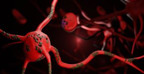 Foto: (Chinnachart Martmoh/istock)