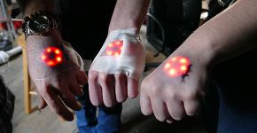 Biohackers alemães implantam luzes LED debaixo da pele