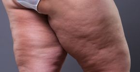 Foto: (Staras/istock)
