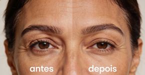 Por que seu rosto parece mais velho que sua idade? Entenda as principais causas