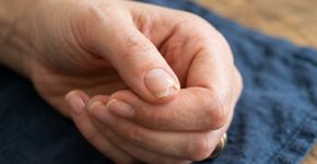 A unha lasca sempre no mesmo canto e isso pode ter mais relação com a rotina das mãos do que com o esmalte usado