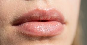 Os lábios ressecam e você passa a língua para aliviar: dermatologistas explicam por que esse hábito pode prolongar o incômodo