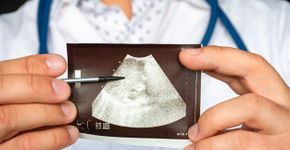 Foto: (Shidlovski/istock)