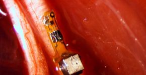 Cientistas criam micro sensores para captar dados do corpo humano