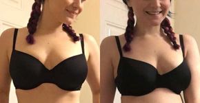Blogueira compara fotos suas para falar de padrão de beleza