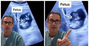 Médico mostra exame em que feto cresce no fígado da mãe
