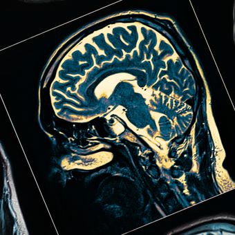 Featured mobile: Cientistas descobriram um gatilho oculto do Alzheimer e o desativaram