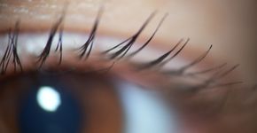 Foto: (Radu Bighian/istock)