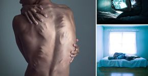 Jovem usa fotografia para enfrentar depressão