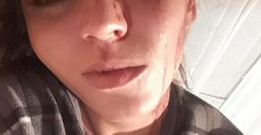 Traída, jovem pede fim do relacionamento e é agredida em Caxias