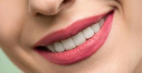 Sorriso mais branco em casa: Técnica aprovada por dentistas