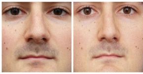 Entenda por que a selfie distorce e aumenta seu nariz