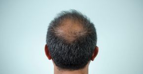 Foto: (herkisi/istock)