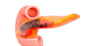 Foto: (luismmolina/istock)