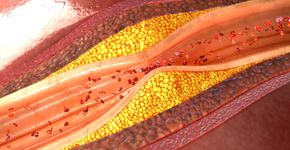 Foto: (sciencepics/DepositPhotos)