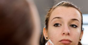 Acne: 10 dicas para cuidar bem da pele no verão