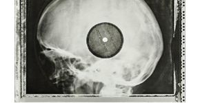Jovens soviéticos pirateavam discos de rock em chapas de raio-x nos anos 1950