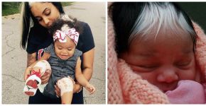 Conheça Milli, a bebê que nasceu com o cabelo branco