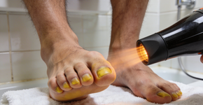 Unhas grossas e amareladas: um secador de cabelo comum salva os pés melhor do que qualquer creme