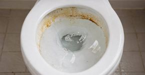Como se livrar para sempre de manchas no vaso sanitário