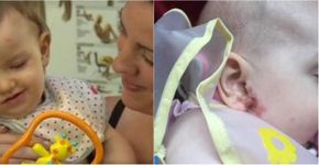Bebê contrai herpes por meio de beijos da mãe