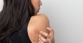 Foto: (chokja/istock)