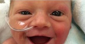 Sorriso de bebê prematuro encanta