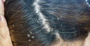 Foto: (Doucefleur/istock)