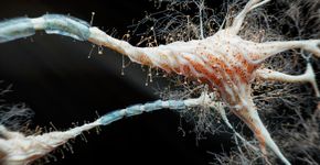 Foto: (koto_feja/istock)