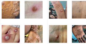 Foto: (Agência de Segurança Sanitária do Reino Unido)