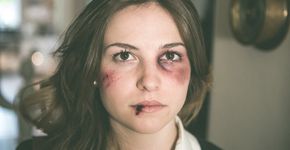 Por ser “bonita demais” jovem é vítima de violência na escola; relembre ações contra o bullying