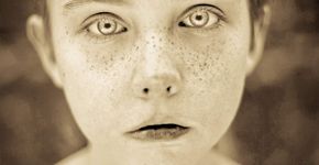 Fotógrafo retrata a beleza de pessoas com sardas