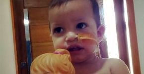 Mãe põe ‘sonda’ em boneca para bebê não se sentir diferente