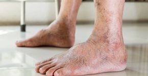 Foto: (iStock/Satjawat Boontanataweepol)
