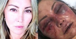 Elaine Caparroz se manifesta sobre espancamento no Instagram