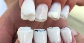 ‘Unhas de dentes’ provam que não há limites para a nail art