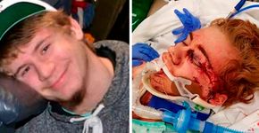 Adolescente de 14 anos aceita desafio compartilhado no Youtube e quase morre