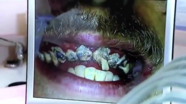 O descuido espantou os dentistas