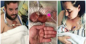 Bebê que nasceu de 22 semanas desafia prognóstico médico e evolui