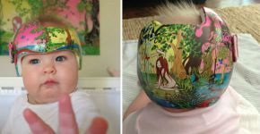 Artista decora capacetes de bebês com deformação craniana