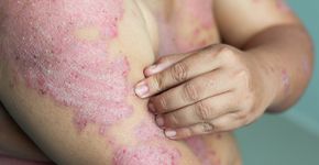 Foto: (Ranee Sornprasitt/istock)