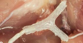 Técnica 3D pode ajudar na recuperação de nervos danificados