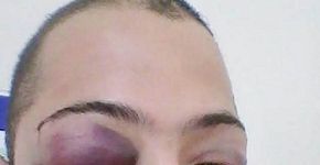 Estudantes acusam policiais por agressão e invasão de propriedade em república universitária