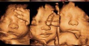 Foto: (reprodução/instagram/sweet3dbaby)