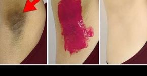 6 dicas naturais para clarear as axilas