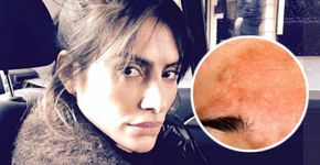 Uma aula com os vícios e as manchas no corpo de Cleo Pires