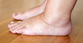 Foto: (Ruslana Chub/istock)