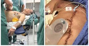 Vídeo da Record com médico cria fake news de câncer de Bolsonaro